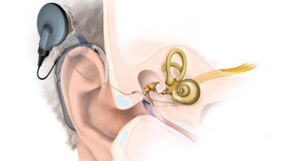 宝宝听力不通过怎么干预,婴儿检查耳朵听力未通过