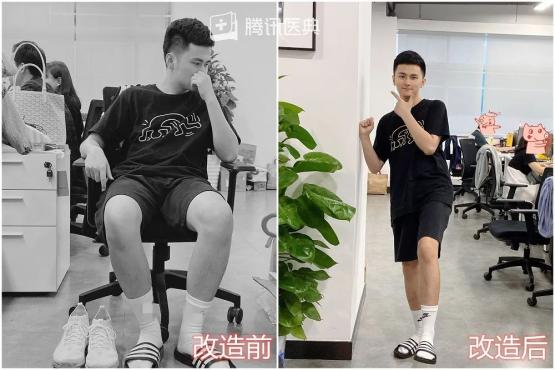 25岁男人脚臭,25岁帅哥脚臭怎么办