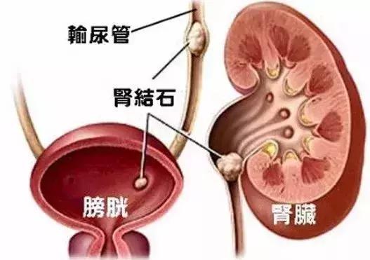 男性小腹痛吃什么消炎药,小腹痛男性坐着就没事了