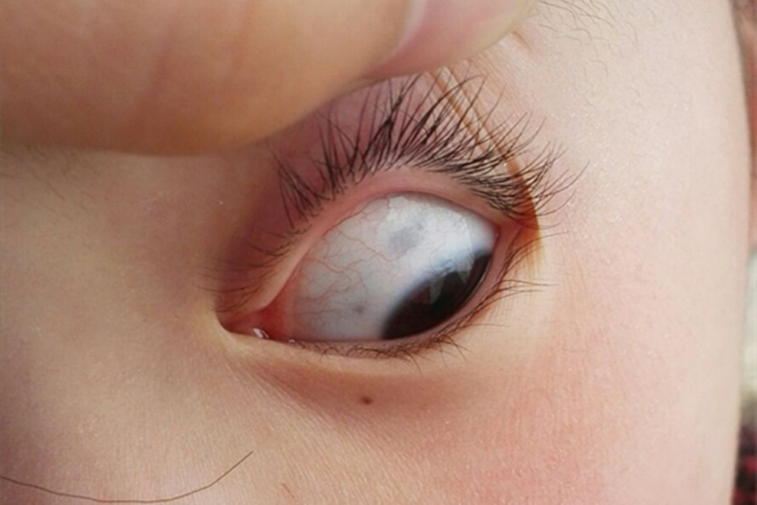 孩子眼白有小黑点是不好的表现吗,孩子眼白有青点是怎么回事