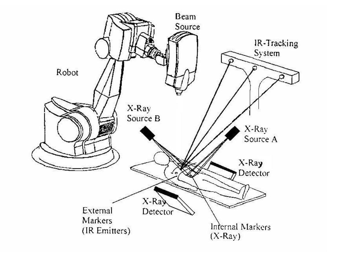 医用粒子加速器,医用加速器的原理