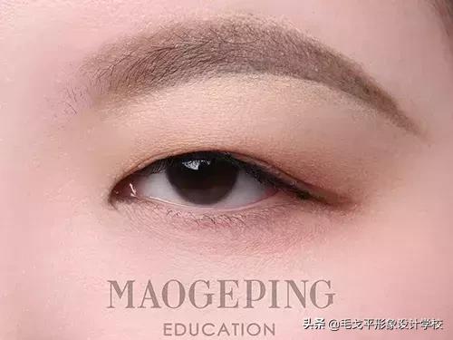 不用手术能弄出双眼皮,不动刀不动针黑科技双眼皮