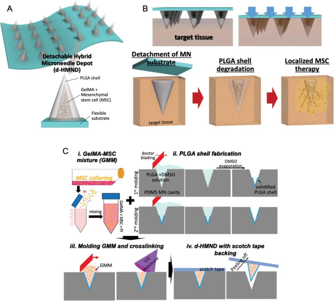 脑科学日报关于记忆,精神分裂症每发作一次伤害大脑