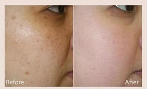 淡斑美白cp霜,美白淡斑cp推荐