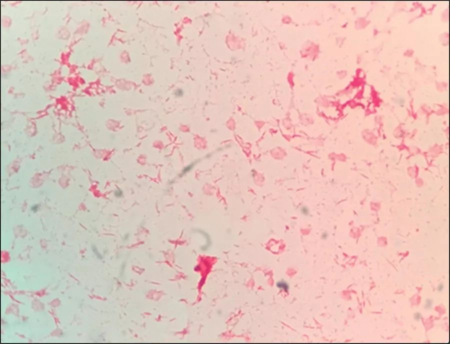 犬咬二氧化碳嗜纤维菌有什么特征,狗狗咬二氧化碳嗜纤维菌