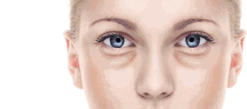 眶隔脂肪释放去眼袋需要多少钱,去眼袋不做眶隔释放可以吗