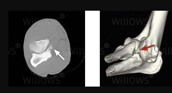 犬分离性软骨病,犬的主要疾病有哪些