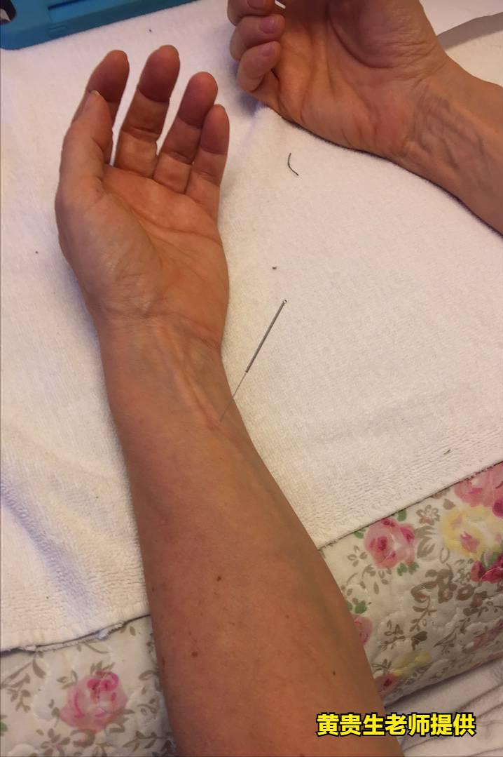 和癌症一起做斗争,癌症防治大赛