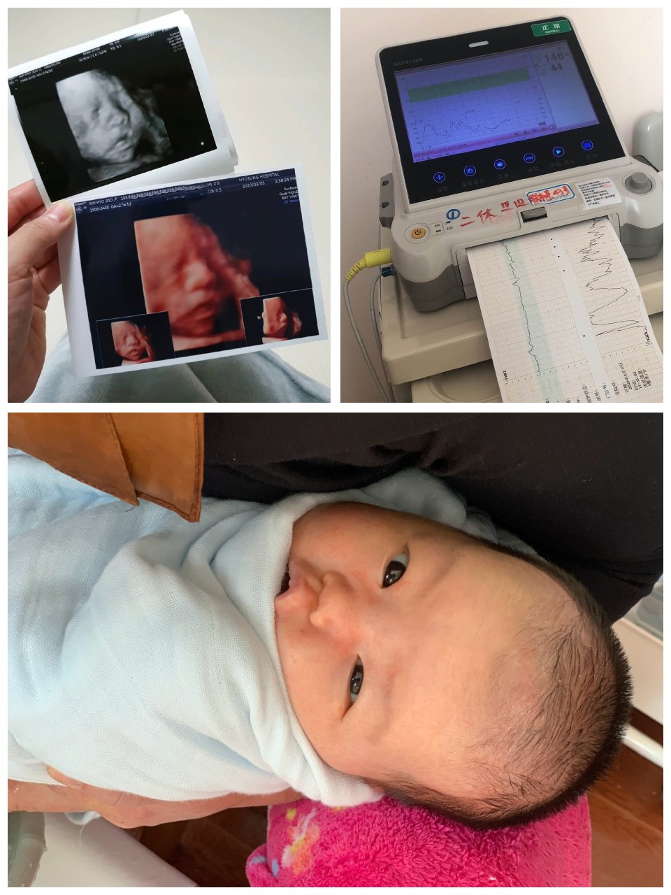 顺产日记好物推荐,顺产日记宝妈