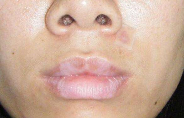 美白路上走过的坑,美白路上走多少弯路