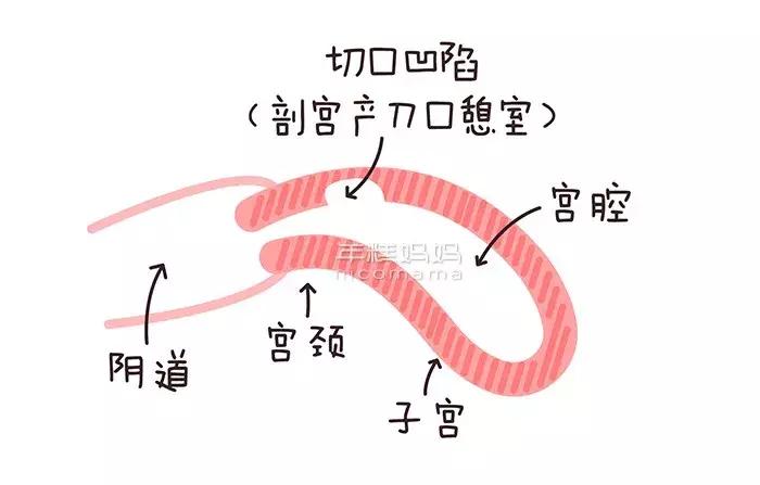 产后子宫恢复得好不好怎么判断,产后喂母乳可以促进子宫恢复吗