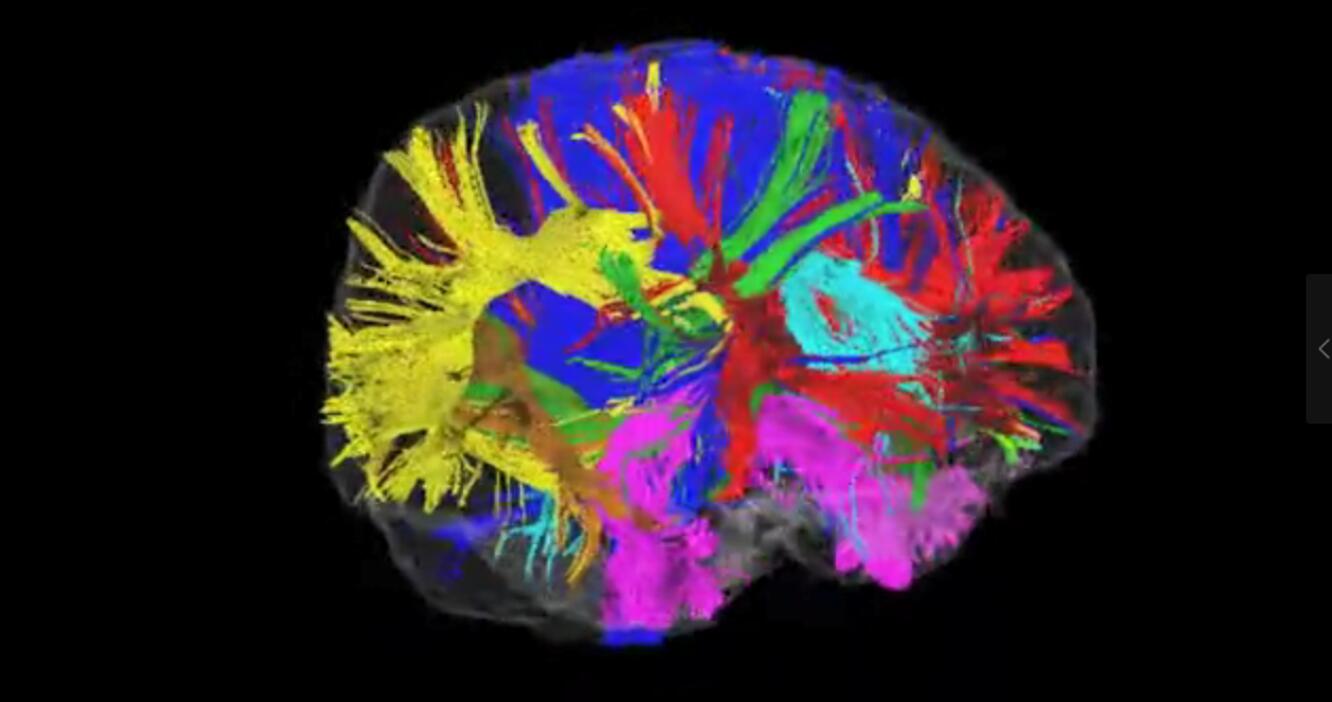 五个能控制你大脑的可怕实验,电击治疗精神分裂症会失忆吗