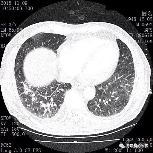 怎么应用统计学做调查,统计学方法可以解决的主要问题
