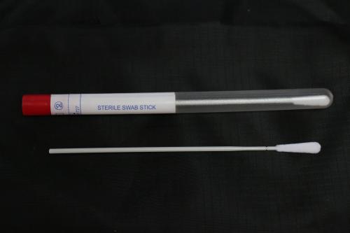 处女能做阴道分泌物检查吗?