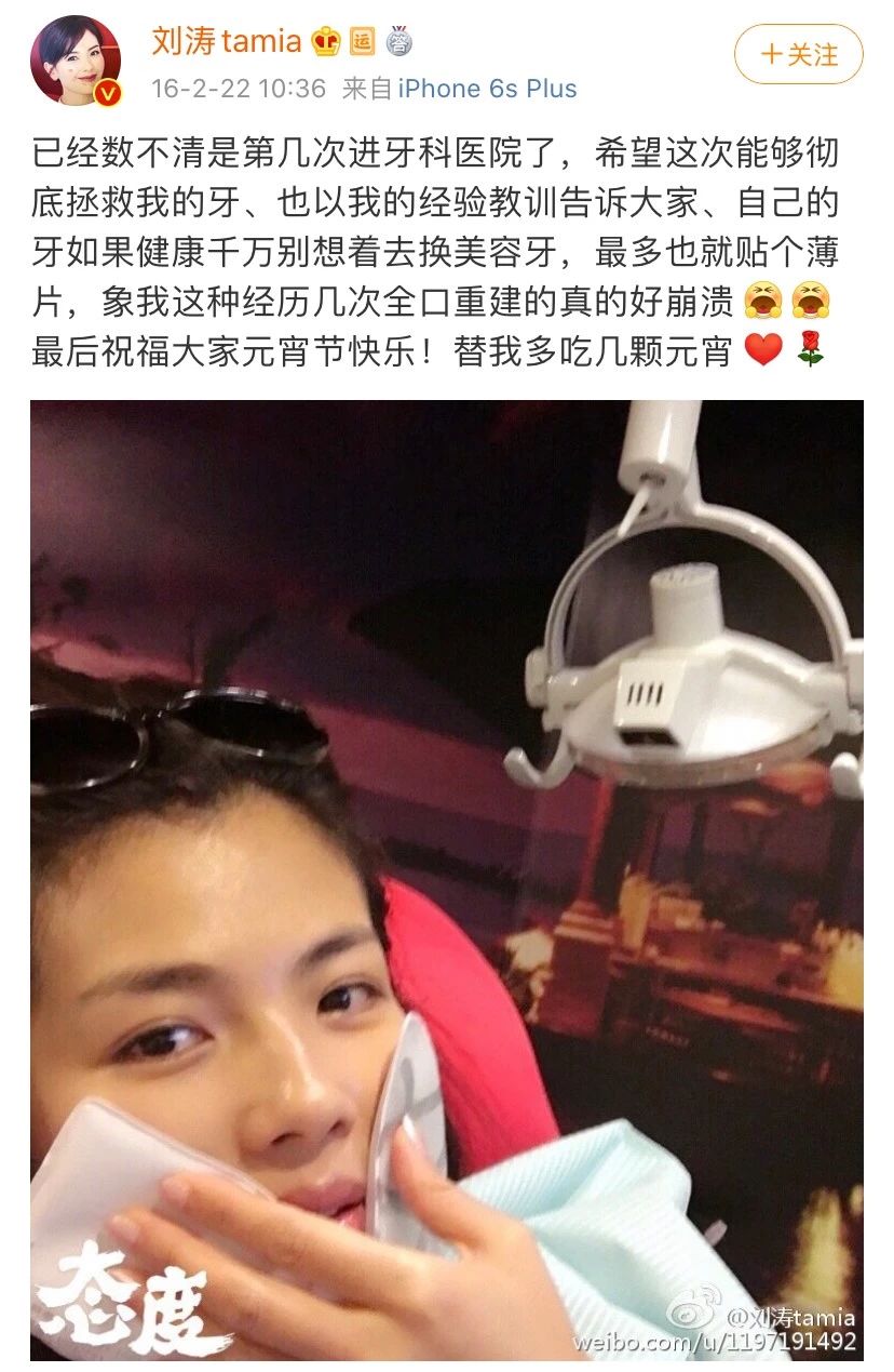 王鸥打瘦脸针真的假的,王鸥真的打过瘦脸针吗