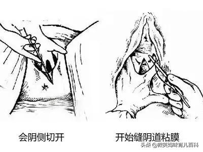 卸货后屁股酸痛怎么回事,卸货肩膀疼怎么办