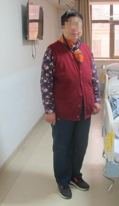 颈椎术后脑脊液漏取什么体位,脊髓型颈椎病手术后植骨愈合时间