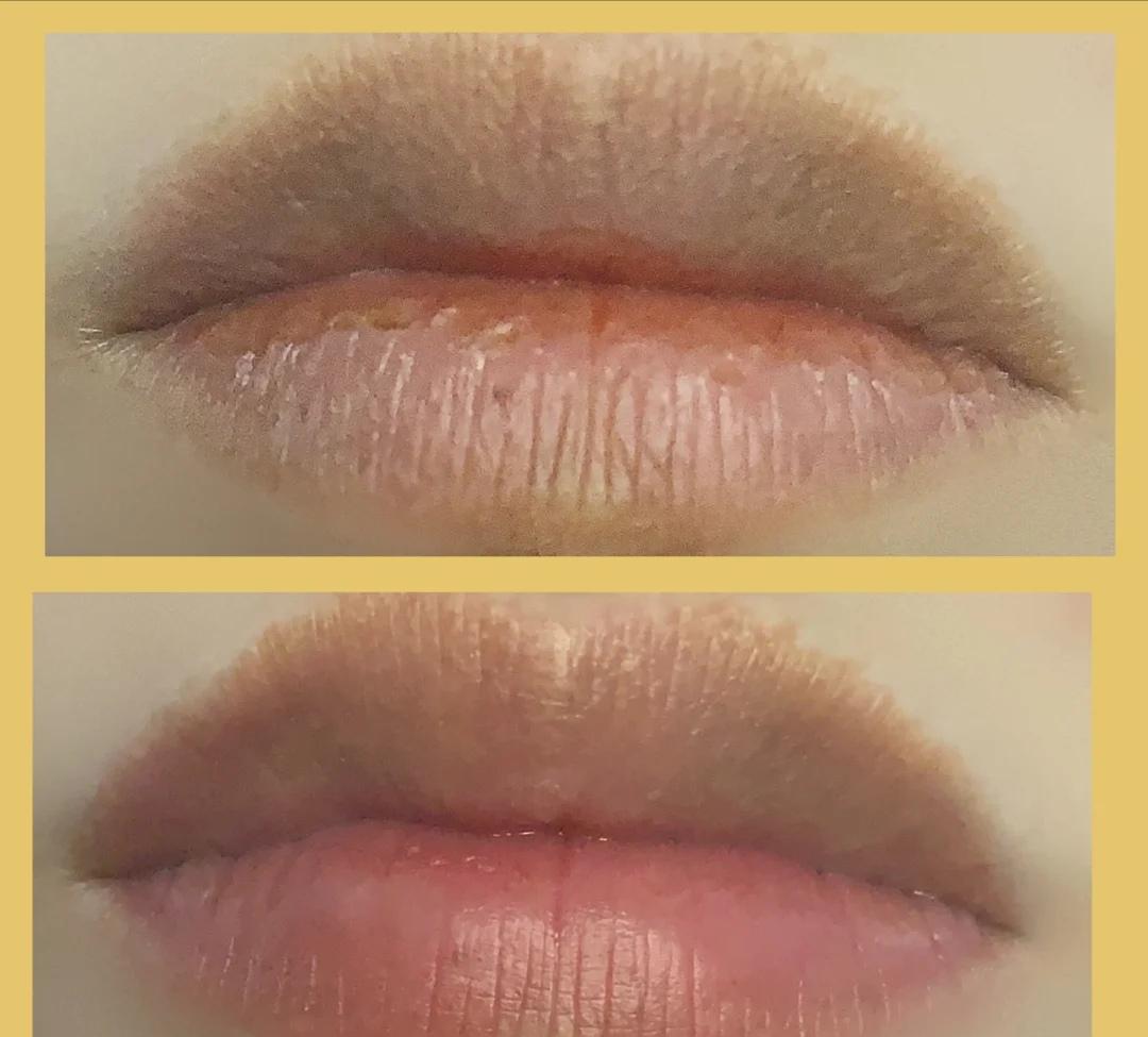 嘴唇好丑怎么变好看,嘴唇为何会越变越难看