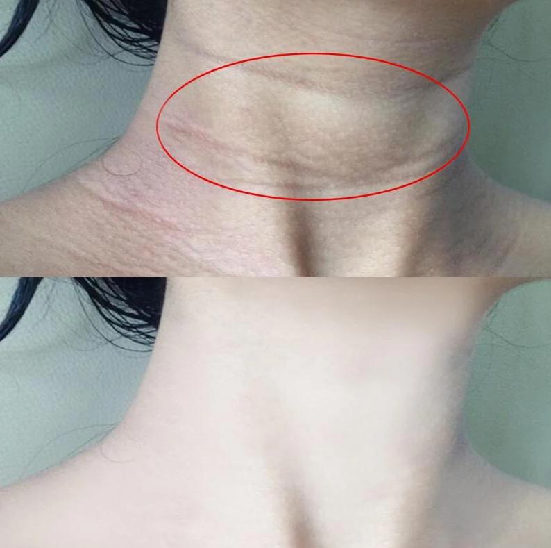 女人脖子三道杠预示什么,女人两眉间有两竖线有什么说法