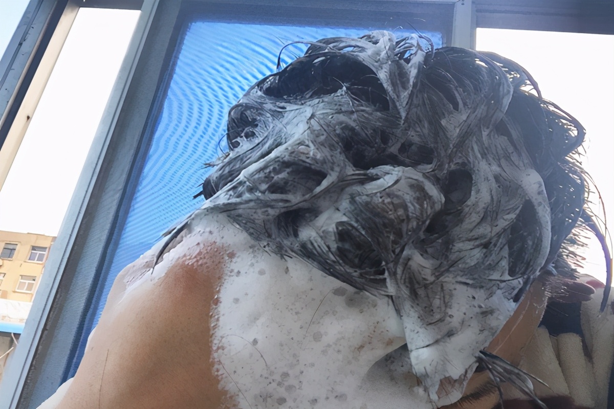 洗完头抓头皮上有白泥怎么解决,如何清洗头皮上覆盖的白泥要抠吗