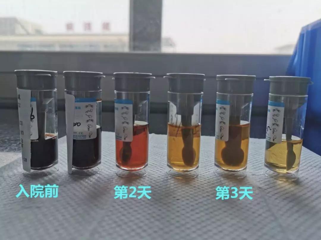 3岁宝宝高烧不退输液,疫情期间3岁宝宝高烧不退
