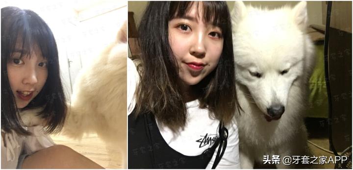 不靠整容怎么改变下巴后缩？看这里