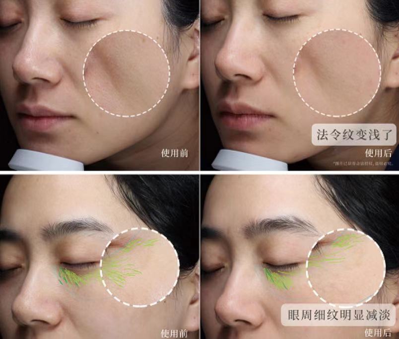 明星都是用什么牌子的美容仪,半个娱乐圈都用美容仪吗