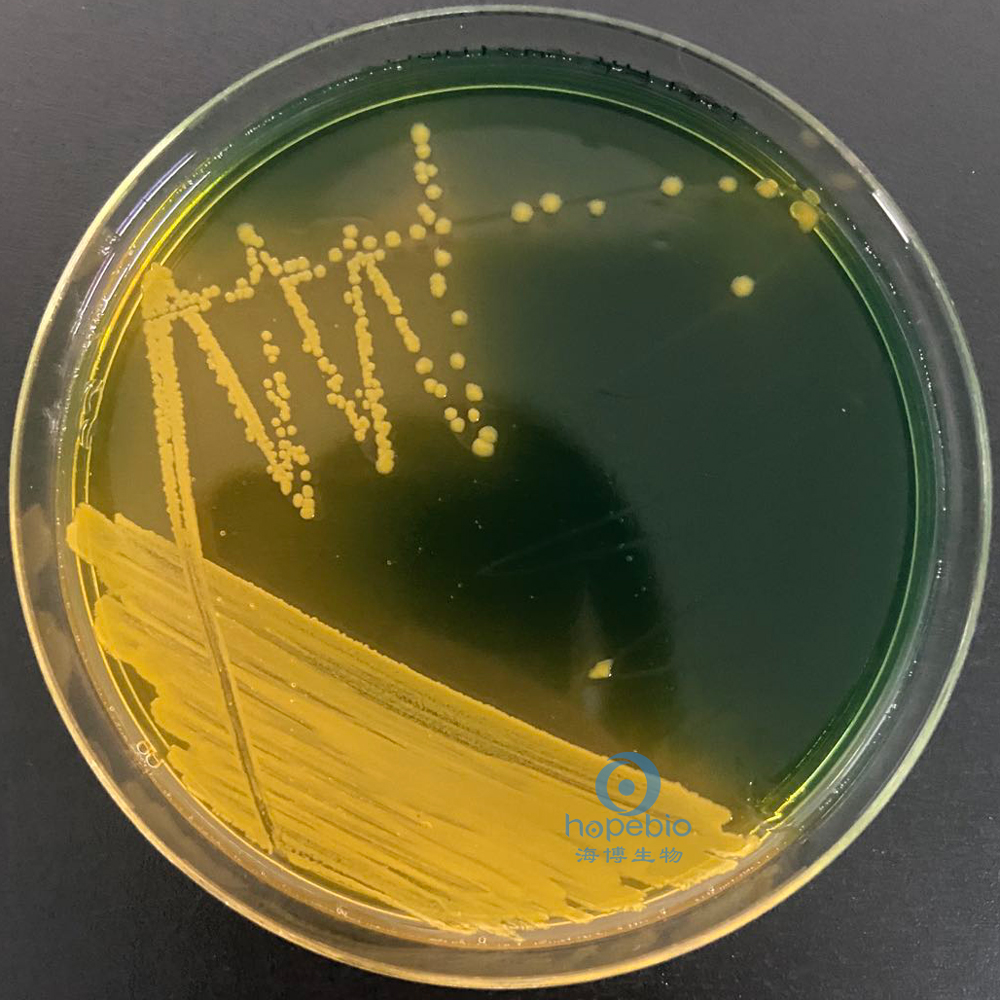 霍乱弧菌分型鉴定,霍乱弧菌的鉴定方法有几种