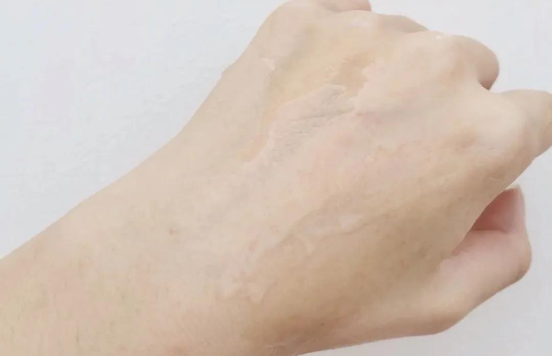 一招教你轻松去黑头,黑头去除小妙招明星