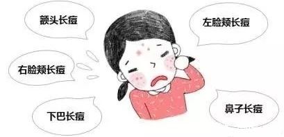 顽固痘痘急救办法是什么,夏季痘痘肌怎么调理