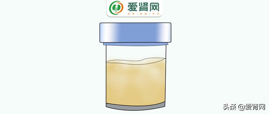 孕妇尿蛋白3+是什么意思,老人尿蛋白3+是怎么回事