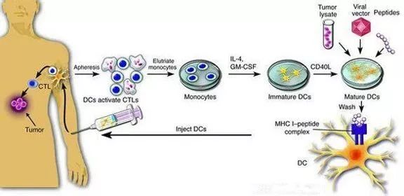 癌症没有所谓根治的概念，如果超过5年没有复发，就算是治好了？