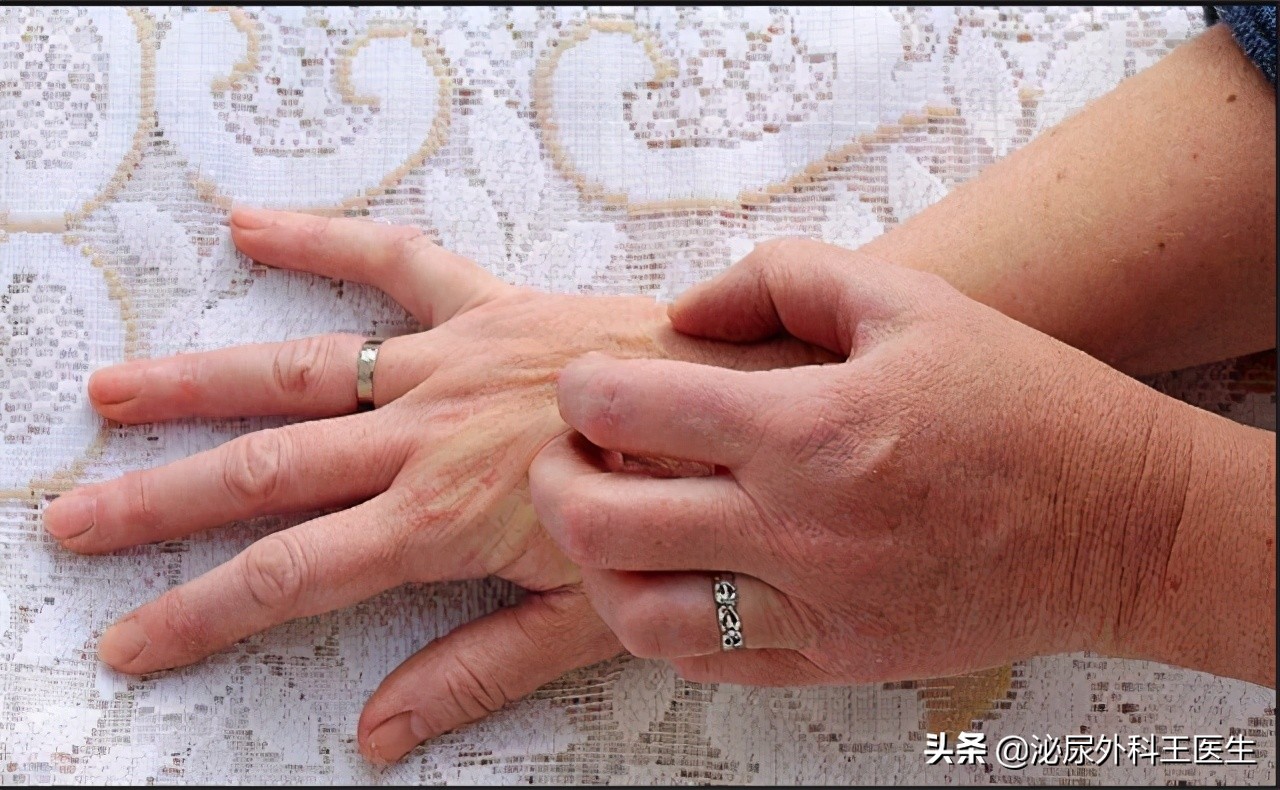 糖尿病并发症皮肤瘙痒怎么治疗,糖尿病引起的皮肤瘙痒的处理方法