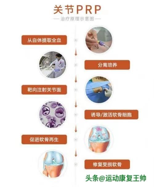患类风湿关节炎吃什么营养品好,膝关节炎的饮食指导和健康宣教