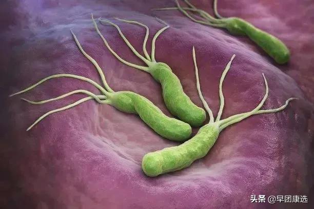 怀孕了查出幽门螺旋杆菌怎么处理,孕妇感染了幽门螺旋杆菌怎么办