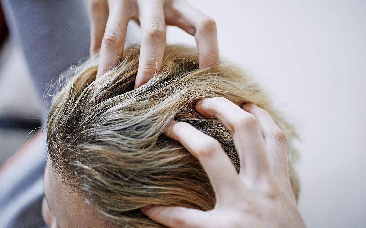 小宝宝脱发严重怎么办,拯救脱发小宝贝