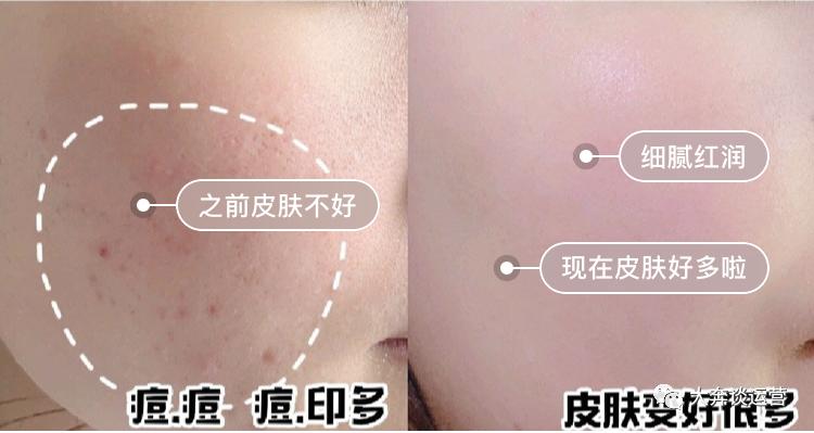 大牌洗面奶哪款好用排行榜最新版,洗面奶到底哪款好用又实惠