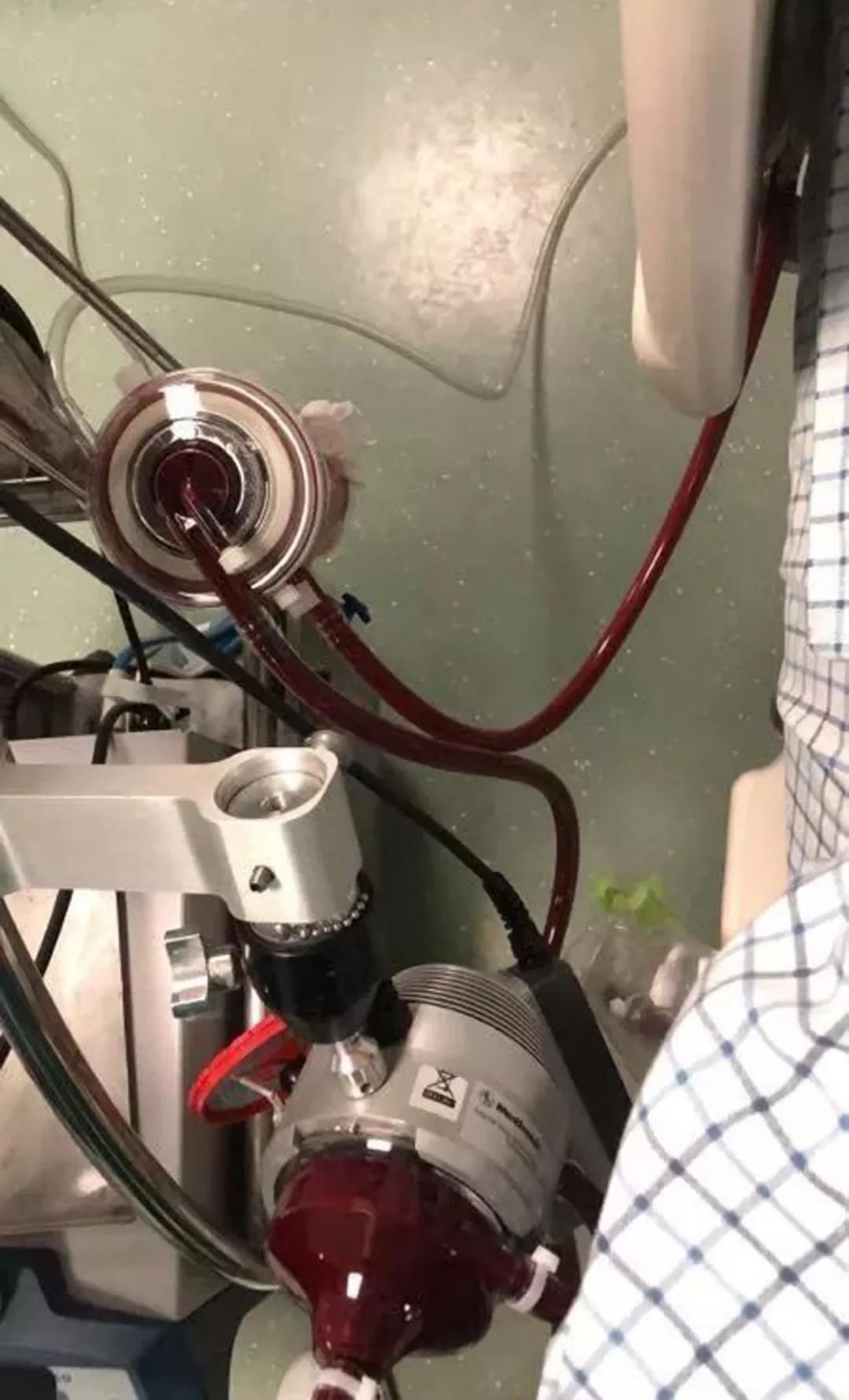 90后妈妈发现胃癌晚期,孕晚期确诊胃癌晚期