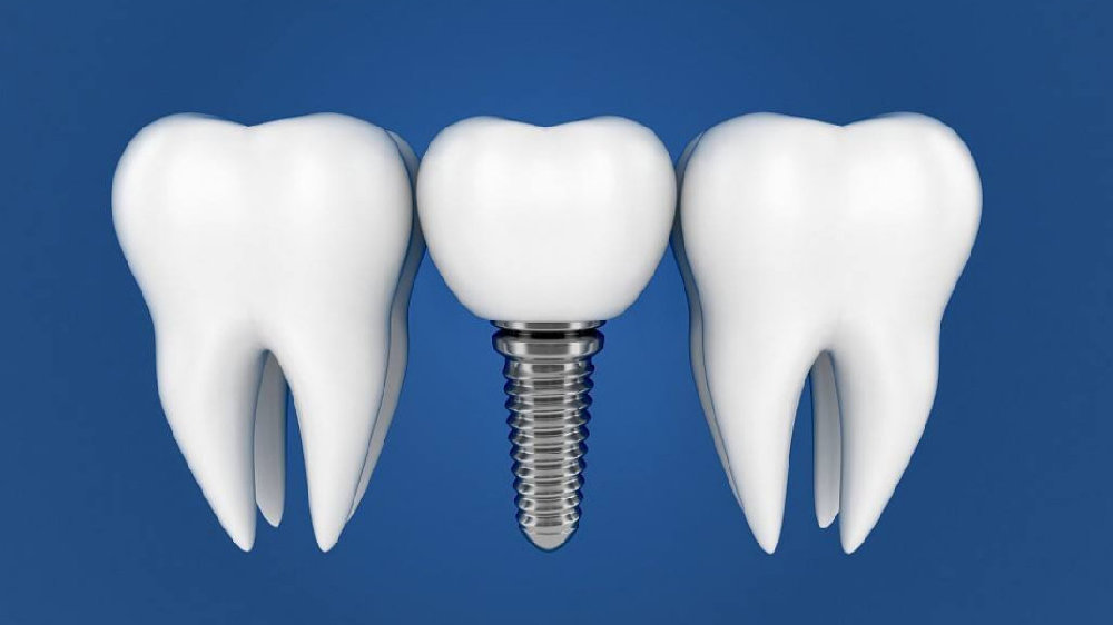 牙病为什么要补牙,牙病经久不愈