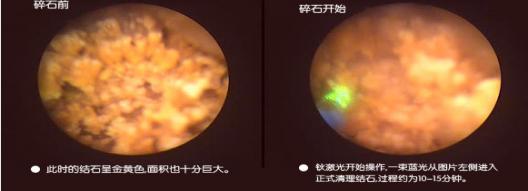 山东治疗泌尿外科比较好的医院,山东大学附属医院泌尿外科专家