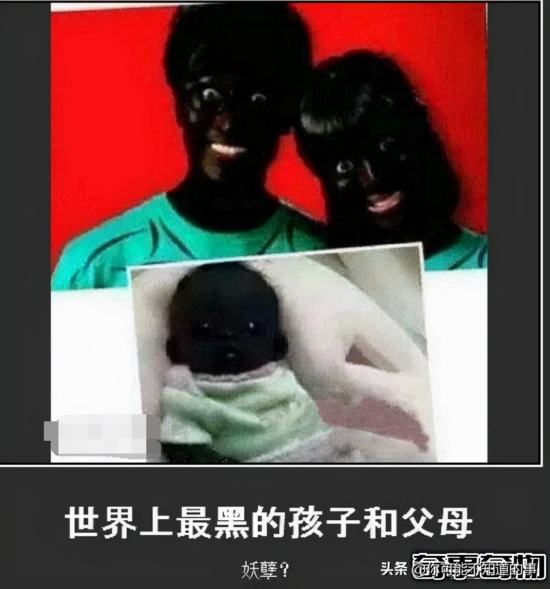 世界上最黑的小孩长大后成这样了,世界上最黑的孩子浑身如煤炭一般