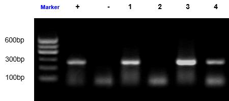 细胞培养中的污染预防措施,细胞培养过程中的支原体污染图片
