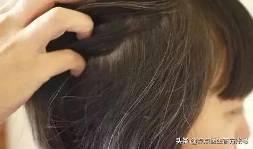 白头发有几根怎么调理变黑发,拔了十根白头发怎么才能不长白发