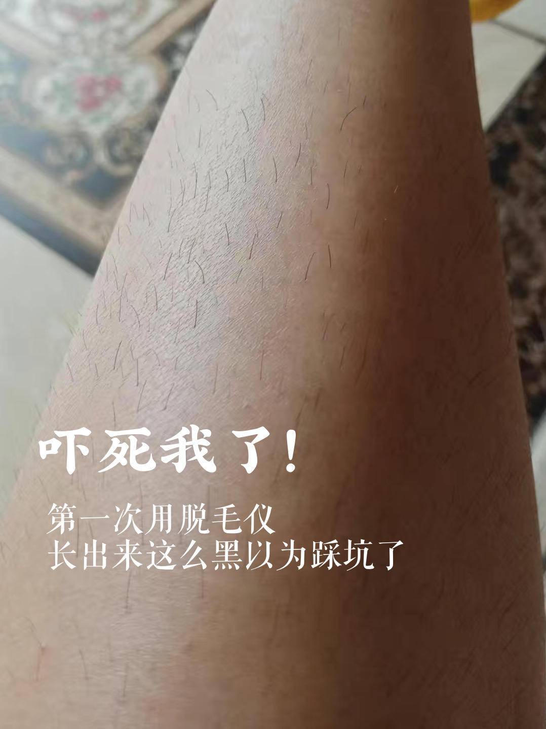 蓝宝石脱毛仪真的能永久去毛吗,ulike蓝宝石3.0脱毛仪