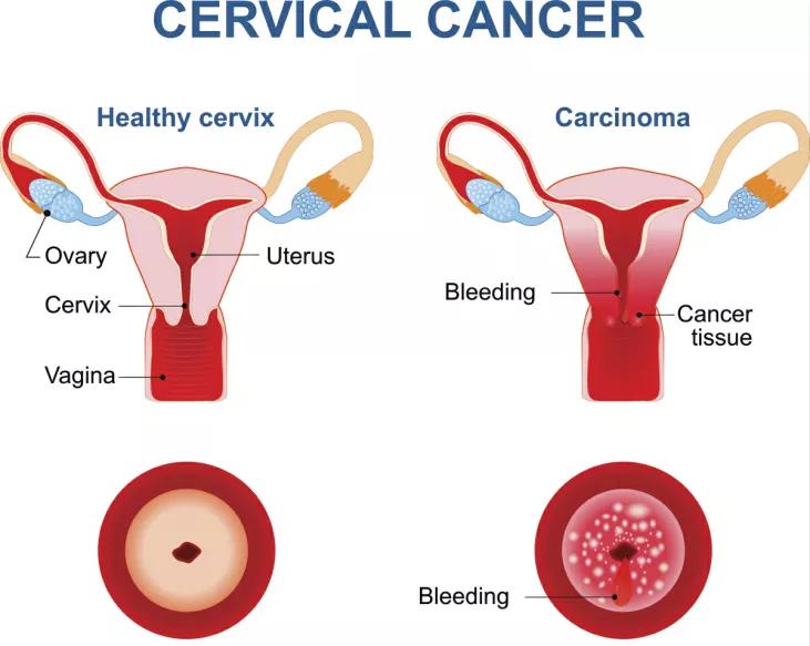 第一次做妇科检查什么感觉,女生第一次妇科检查