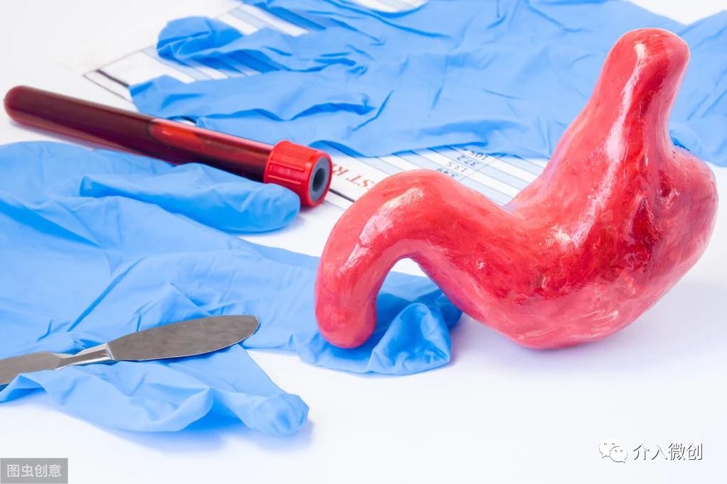 胃癌晚期化疗一次多少钱,胃癌晚期不化疗用靶向药