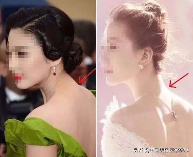 平胸女孩有什么特征,平胸女孩也能穿出高级感