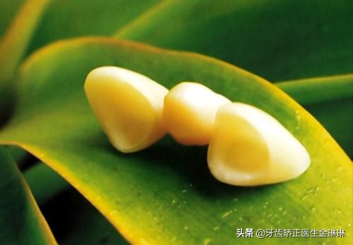 明星全口烤瓷牙的危害,明星为什么都做烤瓷牙