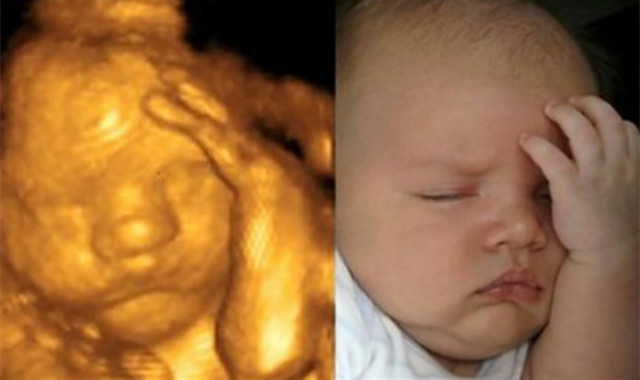 四维彩超要学会看些什么,做四维彩超就能看清宝宝健康吗