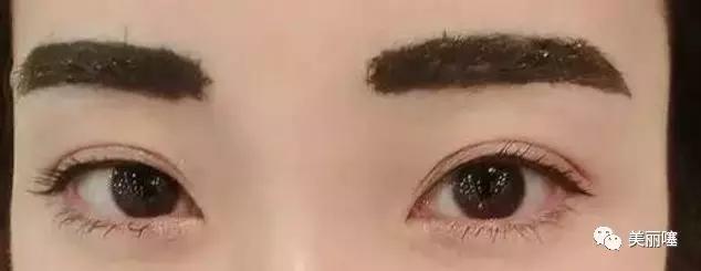 第一批做半飞秒的人怎么样了,半永久到底要不要做